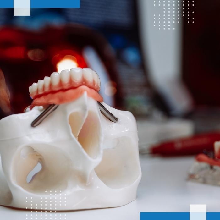 Services Maxillofacial Prosthetics 1