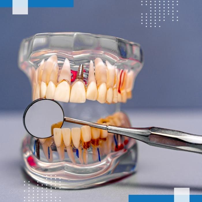 Services Maxillofacial Prosthetics 2