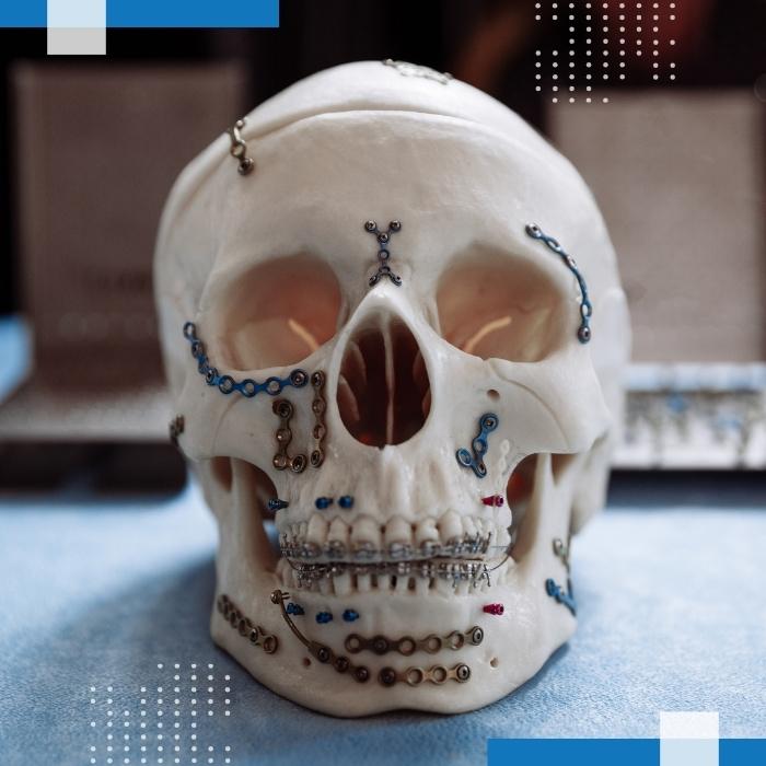 Services Maxillofacial Prosthetics 3